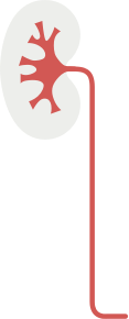 Upper urinary tract graphic